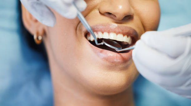 Best Emergency Root Canal Treatment in Hyattsville, MD